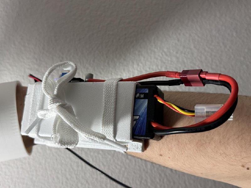 Battery pack on forearm
