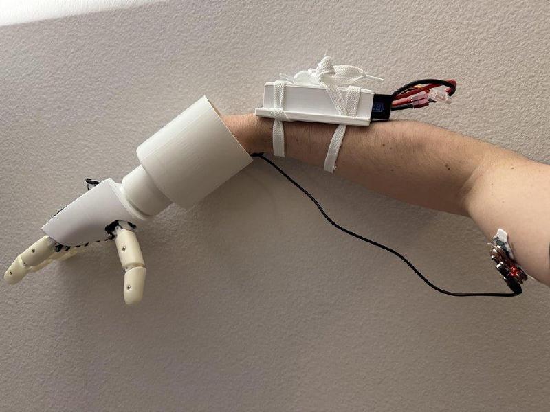 Prosthetic worn on arm